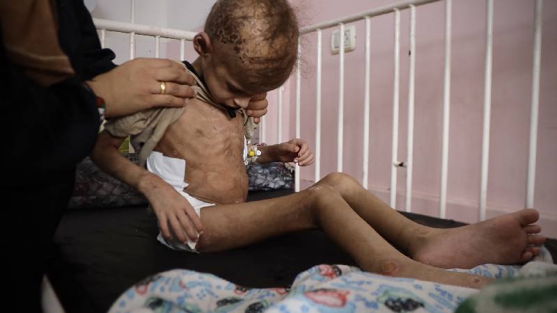 unrwa gazzede 3 yas alti her 3 cocuktan biri son 24 saati yiyeceksiz gecirdi uRaiKIzp